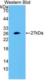 SNAP23 / SNAP-23 Antibody - Western blot of SNAP23 / SNAP-23 antibody.