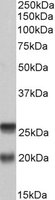 SNAP23 / SNAP-23 Antibody - SNAP23 antibody (0.2 ug/ml) staining of PBMC lysate (35 ug protein/ml in RIPA buffer). Primary incubation was 1 hour. Detected by chemiluminescence.