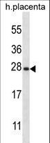 SNAP23 / SNAP-23 Antibody - SNAP23 Antibody western blot of human placenta tissue lysates (35 ug/lane). The SNAP23 antibody detected the SNAP23 protein (arrow).