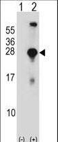 SNAP23 / SNAP-23 Antibody - Western blot of SNAP23 (arrow) using rabbit polyclonal SNAP23 Antibody. 293 cell lysates (2 ug/lane) either nontransfected (Lane 1) or transiently transfected (Lane 2) with the SNAP23 gene.