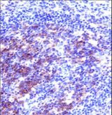 SNAP23 / SNAP-23 Antibody - SNAP23 Antibody immunohistochemistry of formalin-fixed and paraffin-embedded human tonsil tissue followed by peroxidase-conjugated secondary antibody and DAB staining.