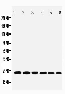 SNAP23 / SNAP-23 Antibody - WB of SNAP23 / SNAP-23 antibody. All lanes: Anti-SNAP23 at 0.5ug/ml. Lane 1: Rat Spleen Tissue Lysate at 40ug. Lane 2: Rat testis Tissue Lysate at 40ug. Lane 3: Rat Ovary Tissue Lysate at 40ug. Lane 4: HELA Whole Cell Lysate at 40ug. Lane 5: MCF-7 Whole Cell Lysate at 40ug. Lane 6: SKOV Whole Cell Lysate at 40ug. Predicted bind size: 23KD. Observed bind size: 23KD.