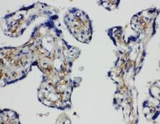 SNAP23 / SNAP-23 Antibody - SNAP23 / SNAP-23 antibody. IHC(P): Human Placenta Tissue.
