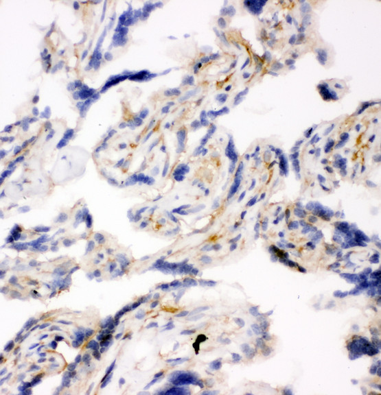 SNAP23 / SNAP-23 Antibody - SNAP23 / SNAP-23 antibody. IHC(F): Human Placenta Tissue.