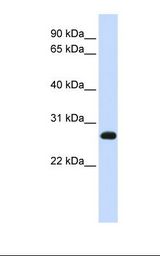 SNAP23 / SNAP-23 Antibody - Jurkat cell lysate. Antibody concentration: 1.0 ug/ml. Gel concentration: 12%.  This image was taken for the unconjugated form of this product. Other forms have not been tested.
