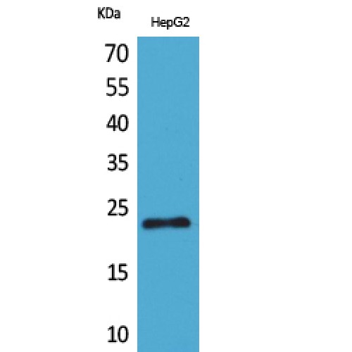 SNAP23 / SNAP-23 Antibody - Western blot of SNAP 23 antibody