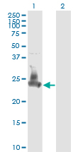SNAP23 / SNAP-23 Antibody - Western blot of SNAP23 expression in transfected 293T cell line by SNAP23 monoclonal antibody (M01), clone 2F5-3D4.