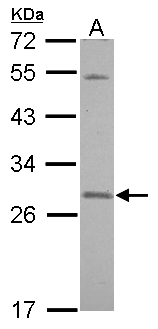 SNAP23 / SNAP-23 Antibody - Sample (30 ug of whole cell lysate) A: A431 12% SDS PAGE SNAP23 antibody diluted at 1:500