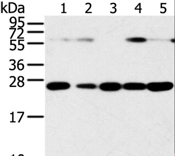 SNAP23 / SNAP-23 Antibody - Western blot analysis of Human placenta tissue and HeLa cell, hepg2 cell and human fetal liver tissue, A549 cell and human normal kidney tissue, using SNAP23 Polyclonal Antibody at dilution of 1:400.