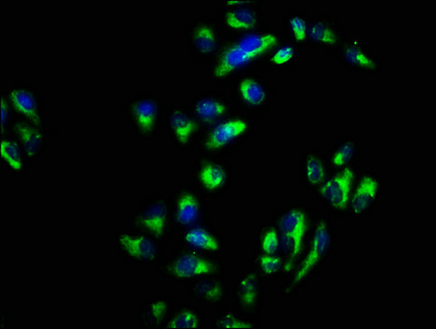 SNAP23 / SNAP-23 Antibody - Immunofluorescence staining of Hela cells with SNAP23 Antibody at 1:66, counter-stained with DAPI. The cells were fixed in 4% formaldehyde, permeabilized using 0.2% Triton X-100 and blocked in 10% normal Goat Serum. The cells were then incubated with the antibody overnight at 4°C. The secondary antibody was Alexa Fluor 488-congugated AffiniPure Goat Anti-Rabbit IgG(H+L).