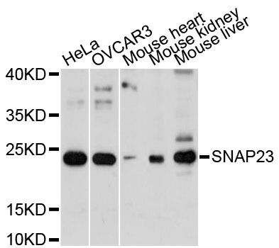 SNAP23 / SNAP-23 Antibody - Western blot analysis of extracts of various cell lines, using SNAP23 antibody at 1:1000 dilution. The secondary antibody used was an HRP Goat Anti-Rabbit IgG (H+L) at 1:10000 dilution. Lysates were loaded 25ug per lane and 3% nonfat dry milk in TBST was used for blocking. An ECL Kit was used for detection and the exposure time was 60s.