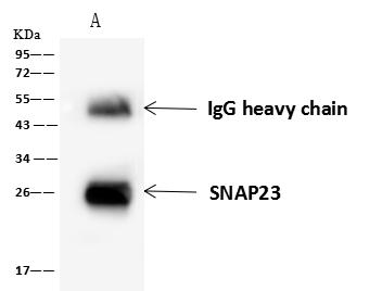 SNAP23 / SNAP-23 Antibody - SNAP23 was immunoprecipitated using: Lane A: 0.5 mg HEK293 Whole Cell Lysate. 4 uL anti-SNAP23 rabbit polyclonal antibody and 60 ug of Immunomagnetic beads Protein A/G. Primary antibody: Anti-SNAP23 rabbit polyclonal antibody, at 1:100 dilution. Secondary antibody: Goat Anti-Rabbit IgG (H+L)/HRP at 1/10000 dilution. Developed using the ECL technique. Performed under reducing conditions. Predicted band size: 23 kDa. Observed band size: 26 kDa.