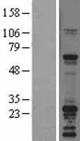 SNAP23 / SNAP-23 Protein - Western validation with an anti-DDK antibody * L: Control HEK293 lysate R: Over-expression lysate
