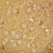SNAP25 Antibody -  This image was taken for the unconjugated form of this product. Other forms have not been tested.