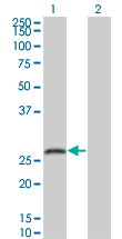 SNAP25 Antibody - Western Blot analysis of SNAP25 expression in transfected 293T cell line by SNAP25 monoclonal antibody (M01), clone 4A3.Lane 1: SNAP25 transfected lysate(23.315 KDa).Lane 2: Non-transfected lysate.
