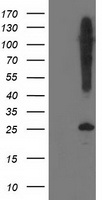 SNAP25 Antibody - HEK293T cells were transfected with the pCMV6-ENTRY control (Left lane) or pCMV6-ENTRY SNAP25 (Right lane) cDNA for 48 hrs and lysed. Equivalent amounts of cell lysates (5 ug per lane) were separated by SDS-PAGE and immunoblotted with anti-SNAP25.