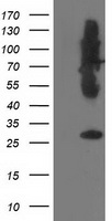 SNAP25 Antibody - HEK293T cells were transfected with the pCMV6-ENTRY control (Left lane) or pCMV6-ENTRY SNAP25 (Right lane) cDNA for 48 hrs and lysed. Equivalent amounts of cell lysates (5 ug per lane) were separated by SDS-PAGE and immunoblotted with anti-SNAP25.