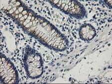 SNAP25 Antibody - IHC of paraffin-embedded Human colon tissue using anti-SNAP25 mouse monoclonal antibody.