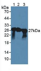 SNAP25 Antibody - Western Blot; Sample: Lane1: Mouse Spinal Cord Tissue; Lane2: Mouse Cerebellum Tissue; Lane3: Porcine Brain Tissue.