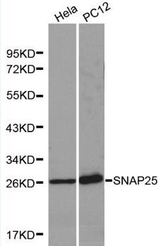 SNAP25 Antibody - Western blot of SNAP25 pAb in extracts from Hela and PC12 cells.