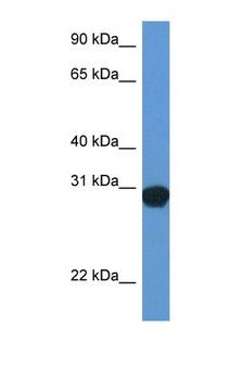 SNAP29 Antibody - SNAP29 antibody Western blot of Rat Lung lysate. Antibody concentration 1 ug/ml.  This image was taken for the unconjugated form of this product. Other forms have not been tested.