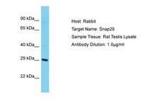 SNAP29 Antibody -  This image was taken for the unconjugated form of this product. Other forms have not been tested.