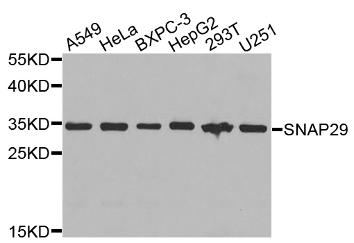 SNAP29 Antibody - Western blot analysis of extracts of various cells.