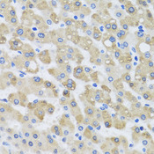 SNAP29 Antibody - Immunohistochemistry of paraffin-embedded human liver injury tissue.