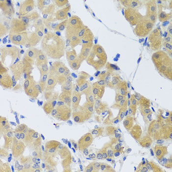 SNAP29 Antibody - Immunohistochemistry of paraffin-embedded human stomach tissue.