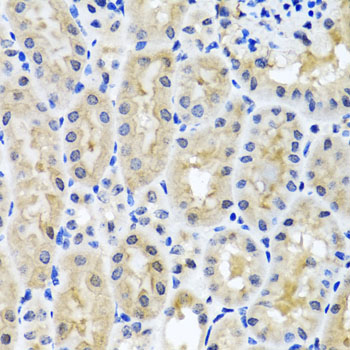 SNAP29 Antibody - Immunohistochemistry of paraffin-embedded mouse kidney tissue.