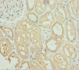 SNAP29 Antibody - Immunohistochemistry of paraffin-embedded human kidney tissue at dilution 1:100