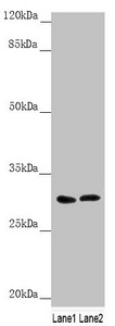 SNAP29 Antibody - Western blot All Lanes: SNAP29 antibody at 1.79 ug/ml Lane 1: 293T whole cell lysate Lane 2: Jurkat whole cell lysate Secondary Goat polyclonal to rabbit IgG at 1/10000 dilution Predicted band size: 29 kDa Observed band size: 29 kDa