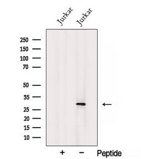 SNAP29 Antibody - Western blot analysis of extracts of Jurkat cells using SNAP29 antibody. The lane on the left was treated with blocking peptide.