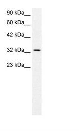 SNAP45 / SNAPC2 Antibody - Jurkat Cell Lysate.  This image was taken for the unconjugated form of this product. Other forms have not been tested.