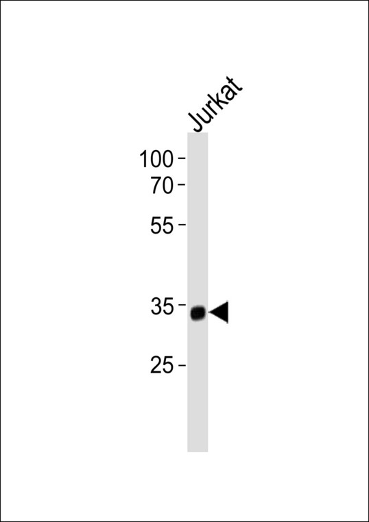 SNAP45 / SNAPC2 Antibody - SNAPC2 Antibody western blot of Jurkat cell line lysates (35 ug/lane). The SNAPC2 antibody detected the SNAPC2 protein (arrow).