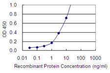 SNAP45 / SNAPC2 Antibody - Detection limit for recombinant GST tagged SNAPC2 is 0.1 ng/ml as a capture antibody.