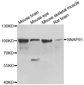 SNAP91 / AP180 Antibody - Western blot analysis of extracts of various cell lines.
