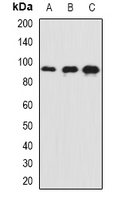 SNAP91 / AP180 Antibody - Western blot analysis of AP180 expression in mouse brain (A); mouse eye (B); rat brain (C) whole cell lysates.
