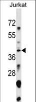 SNAPC1 Antibody - SNAPC1 Antibody western blot of Jurkat cell line lysates (35 ug/lane). The SNAPC1 antibody detected the SNAPC1 protein (arrow).