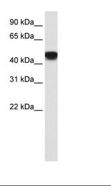 SNAPC1 Antibody - Transfected 293T Cell Lysate.  This image was taken for the unconjugated form of this product. Other forms have not been tested.