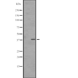 SNAPC3 Antibody - Western blot analysis of SNAPC3 expression in A431 whole cells lysate. The lane on the left is treated with the antigen-specific peptide.