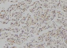 SNAPC3 Antibody - 1:100 staining human lung tissue by IHC-P. The sample was formaldehyde fixed and a heat mediated antigen retrieval step in citrate buffer was performed. The sample was then blocked and incubated with the antibody for 1.5 hours at 22°C. An HRP conjugated goat anti-rabbit antibody was used as the secondary.