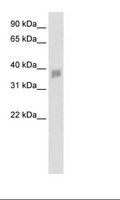 SNAPC3 Antibody - Fetal small Intestine Lysate.  This image was taken for the unconjugated form of this product. Other forms have not been tested.