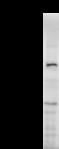 SNAPC4 Antibody - Detection of human SNAPC4 by Western blot. Samples: Whole cell lysate (50 ug) from HeLa cells. Predicted molecular weight: 159 kDa