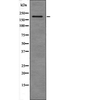 SNAPC4 Antibody - Western blot analysis of expression in HEK293 cells. The lane on the left is treated with the antigen-specific peptide.