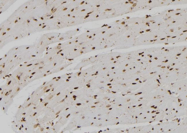 SNAPC4 Antibody - 1:100 staining rat heart tissue by IHC-P. The sample was formaldehyde fixed and a heat mediated antigen retrieval step in citrate buffer was performed. The sample was then blocked and incubated with the antibody for 1.5 hours at 22°C. An HRP conjugated goat anti-rabbit antibody was used as the secondary.