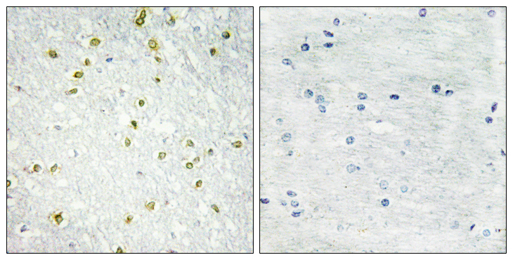 SNAPC5 Antibody - Immunohistochemistry analysis of paraffin-embedded human brain tissue, using SNAPC5 Antibody. The picture on the right is blocked with the synthesized peptide.
