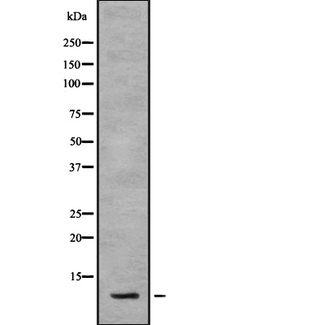 SNAPC5 Antibody - Western blot analysis SNAPC5 using HepG2 whole cells lysates