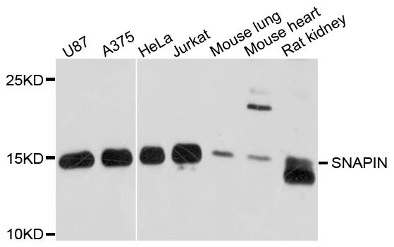 SNAPIN Antibody - Western blot analysis of extracts of various cell lines, using SNAPIN antibody at 1:1000 dilution. The secondary antibody used was an HRP Goat Anti-Rabbit IgG (H+L) at 1:10000 dilution. Lysates were loaded 25ug per lane and 3% nonfat dry milk in TBST was used for blocking. An ECL Kit was used for detection and the exposure time was 30s.