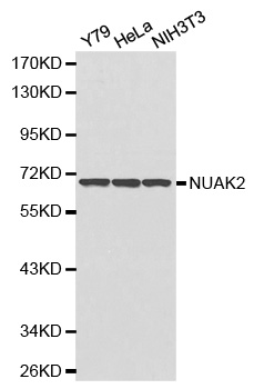SNARK / NUAK2 Antibody - Western blot analysis of extracts of various cell lines.